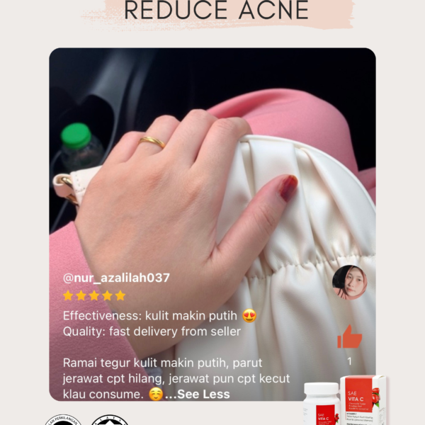 ACNE 5