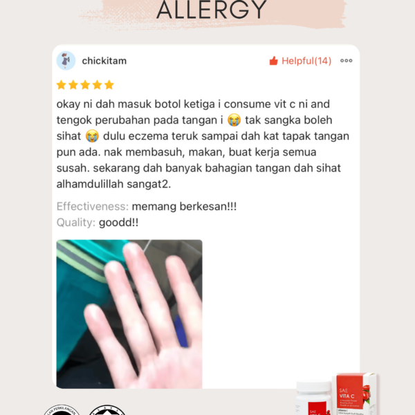 ALLERGY 1